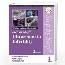Step by Step Ultrasound in Infertility