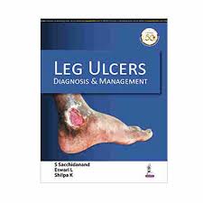 Leg Ulcers: Diagnosis & Management