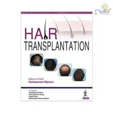 Hair Transplantation