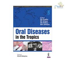 Oral Diseases In The Tropics