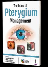 Textbook Of Pterygium Management With Dvd-Rom