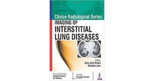 Clinico Radiological Series:Imaging Of Interstitial Lung Diseases