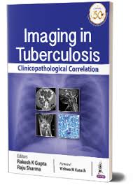 Imaging in Tuberculosis:
Clinicopathological Correlation