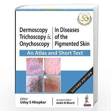Dermoscopy, Trichoscopy & Onychoscopy In Diseases of the Pigmented Skin An Atlas and Short Text