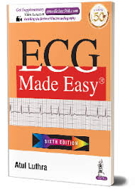 ECG Made Easy
