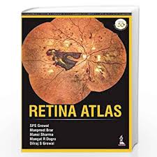 Retina Atlas