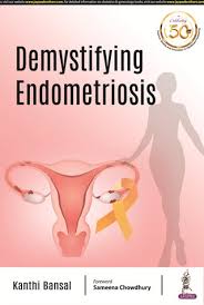 Demystifying Endometriosis