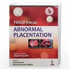 FOGSI Focus Abnormal Placentation