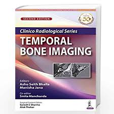 Clinico Radiological Series Temporal Bone Imaging