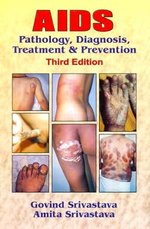 Aids Pathology Diagnosis Treatment And Prevention 3Ed (2012)