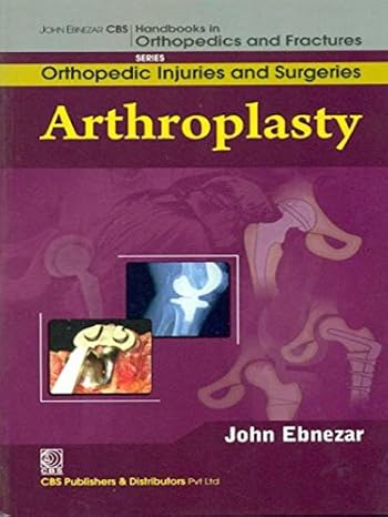 Arthroplasty (Handbooks In Orthopedics And Fractures Series Vol 62 Orthopedic Injuries And Surgeries (2012)