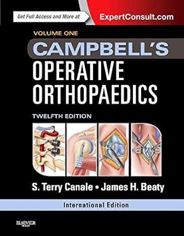 Campbell's Operative Orthopaedics International Edition, 4 Vol.. Set, 12/E 