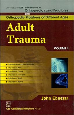 Adult Trauma Vol 1 (Handbooks In Orthopedics And Fractures Series Vol 75 Orthopedic Problems Of Different Ages (2012)
